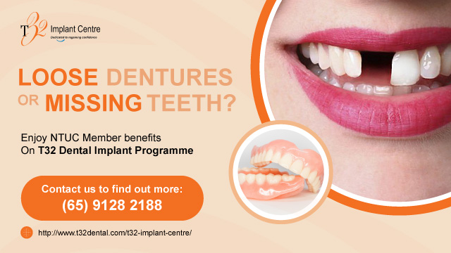 enjoy NTUC Member benefits on T32 Fental implants programme